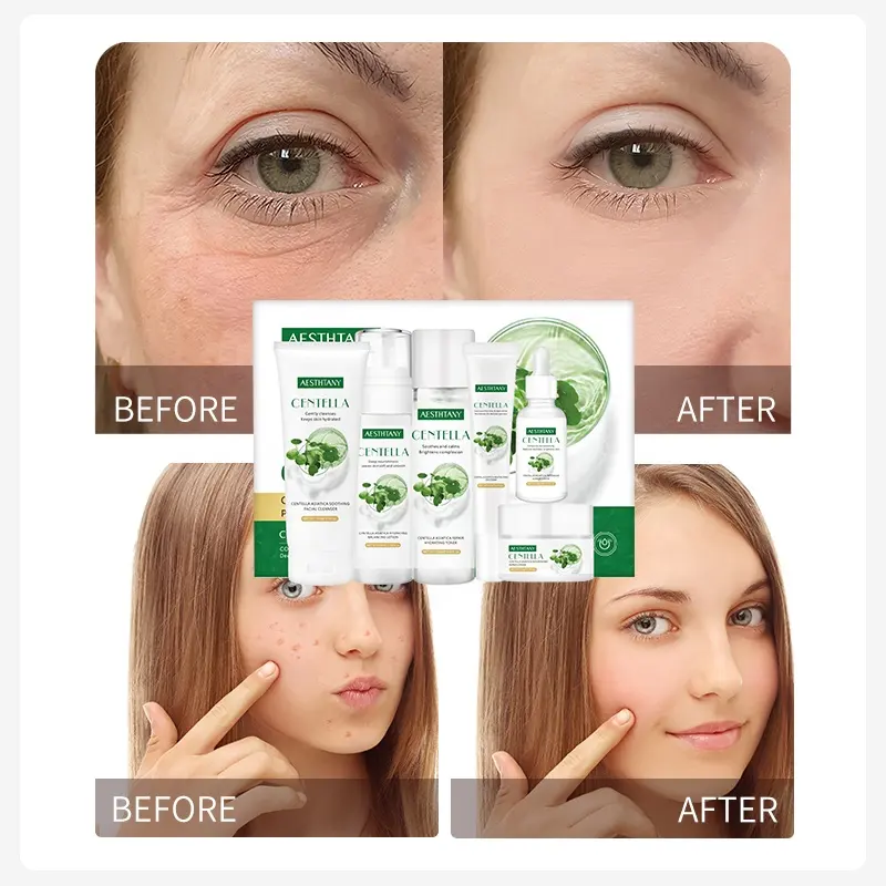 AESTHTANY Centella Asiatica Calming Hydrating Facial Set Vitamin C Elasticity Boosting for Sensitive Skin Daily Care-Luxurious
