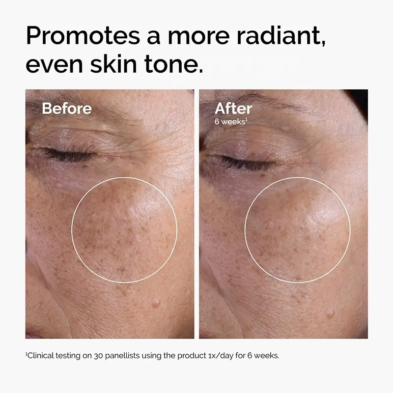 Customized 7% Glycolic Acid Toner to Improve Closed Comedones, Tighten Pores Spray and Moisturizer detail