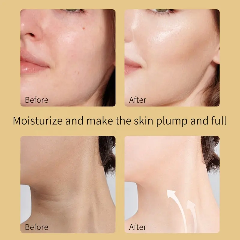 AESTHTANY 150g Bee Venom Face & Neck Cream Nourish Dry and Damaged Barrier Stabilize Skin State for Daily Smoothing Care OEM