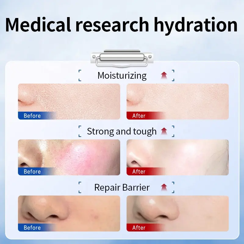 OEM/ODM Custom Face Care Herbal Toner, Moisturizing Lotion & Cream Natural Ingredients, Private Label Support
