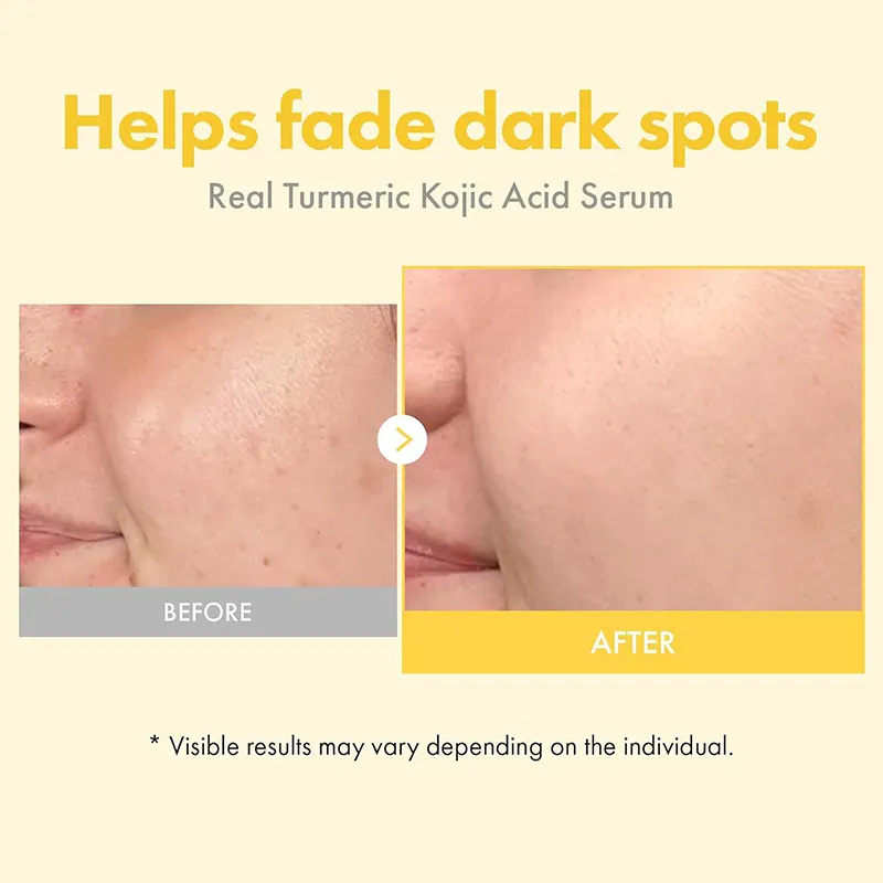 Premium Private Label Turmeric Kojic Acid 33ml Facial Essence for Balancing Uneven Tone and Brightening Dull Skin Daily Care OEM