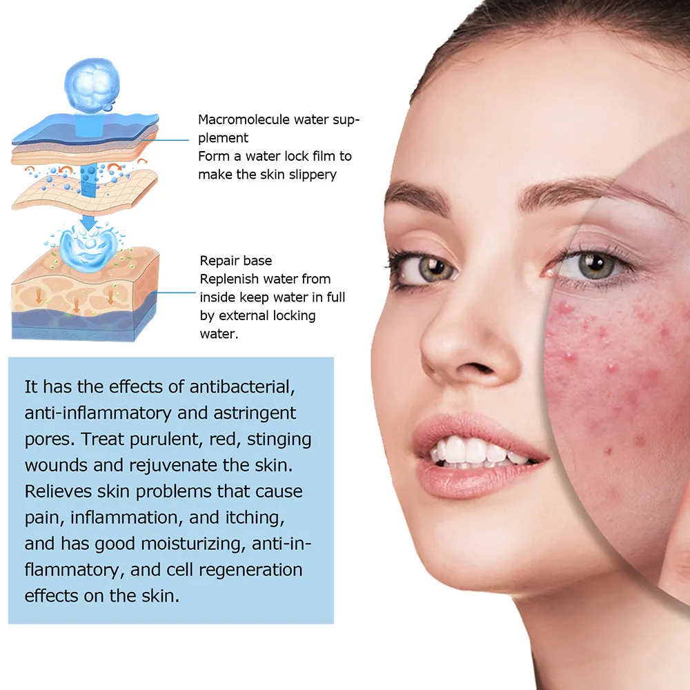 Private Label 2% Salicylic Acid Anti Acne Serum Oil Control Shrink Pores Repair Acne Scar for Oily Sensitive Acne Prone Skin OEM