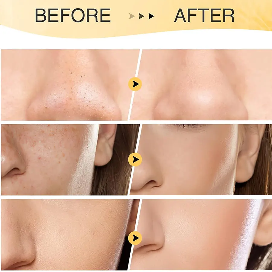 Herbicos Wholesale OEM Vitamin C Turmeric Clay Mask for Skin Lightening Whitening Acne Relief Purify Pores Blackheads