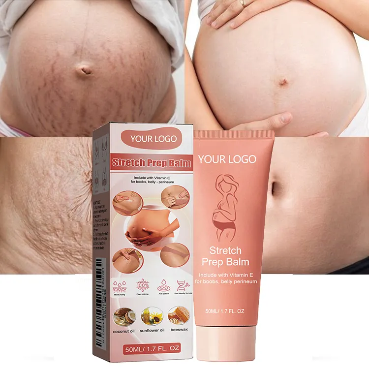 OEM Tummy Leg Facial Scar Cream Pimples Stretch Marks Remove Cream Strong Effective Acne Scar Removal Cream Smagliature