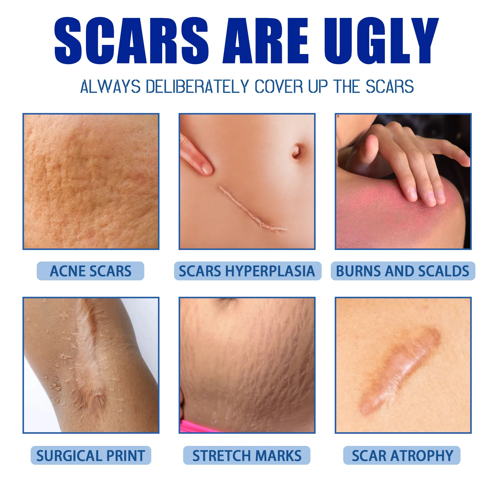 Customized logo Private Label Fastest Scar Removal Gel Bruises Repair Reduce Stretch Marks Scar Repair Cream Oem