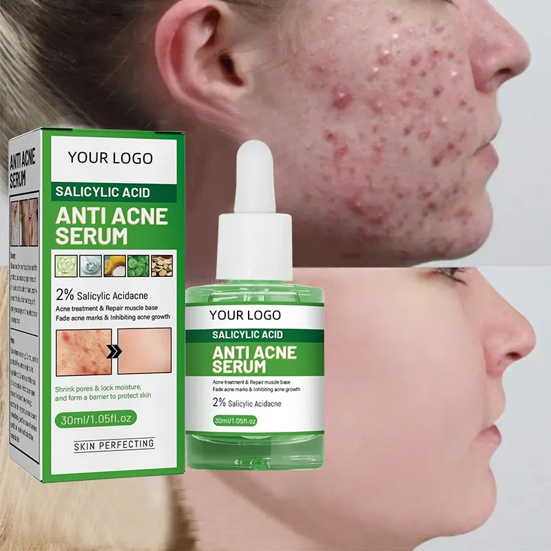 Wholesale Double Effect Acne Removing Serum Private Label Organic Oil Control Exfoliating Repair Acne Repair Face Serum
