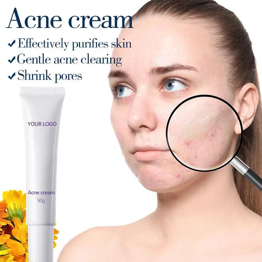 Herbicos Private Brand Wholesale Acne Skin Care Products Customized Plant Extracts Bleach Facial Skin Care Anti-Acne Cream