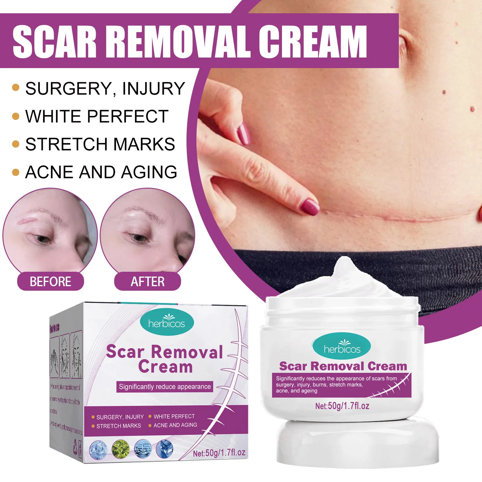 Herbicos Acne Scar Removal Creamstretch Marks Repairing Cream Body Lotion Pregnant Pregnancy Women Day Adults Hyaluronic Acid