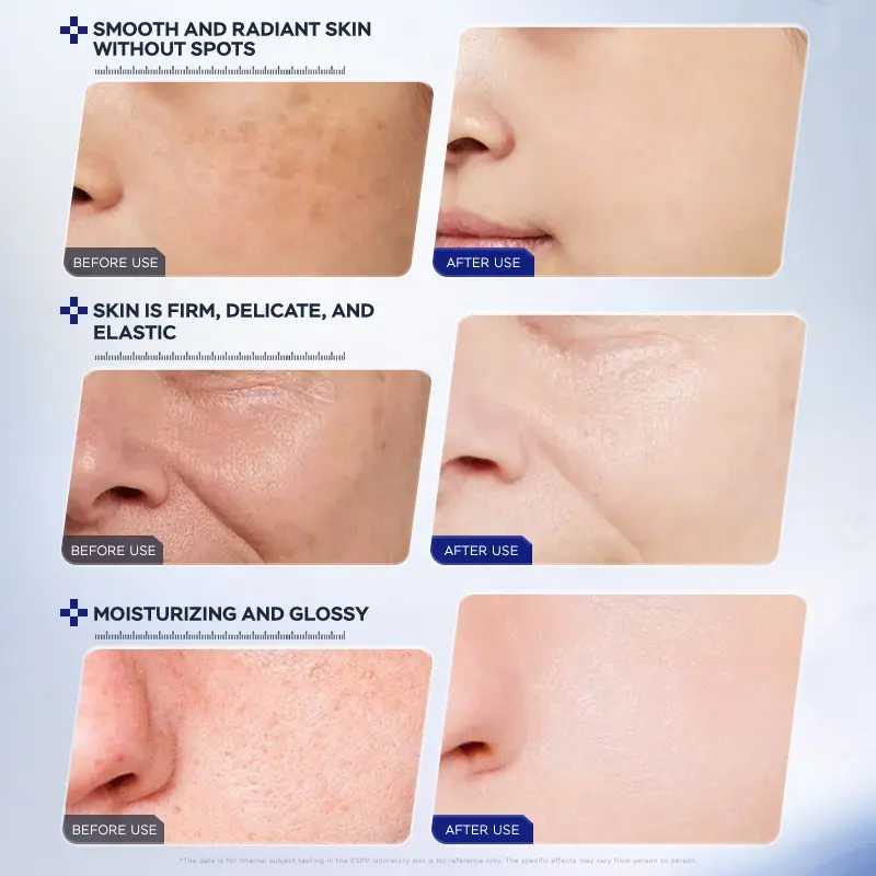 ESCP Facial Serum Vitamin C E Niacinamide Arbutin Complex Boost Natural Skin Luminance Maintain Elasticity Facial Revitalizing