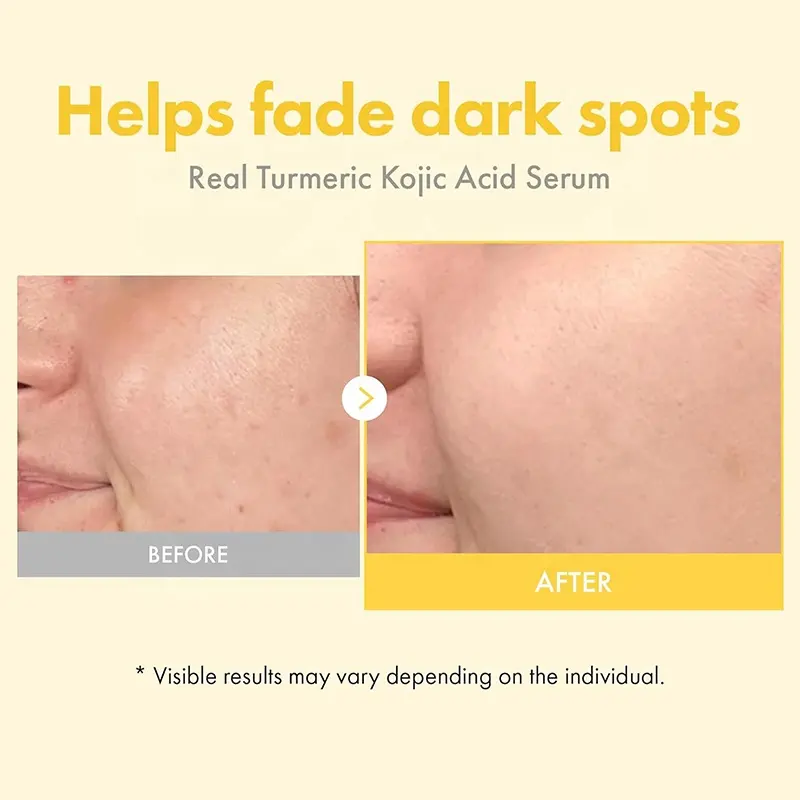Private Label Turmeric Kojic Acid Alpha Arbutin Facial Serum Harmonize Uneven Dull Complexion Nourish Daily Facial Maintenance