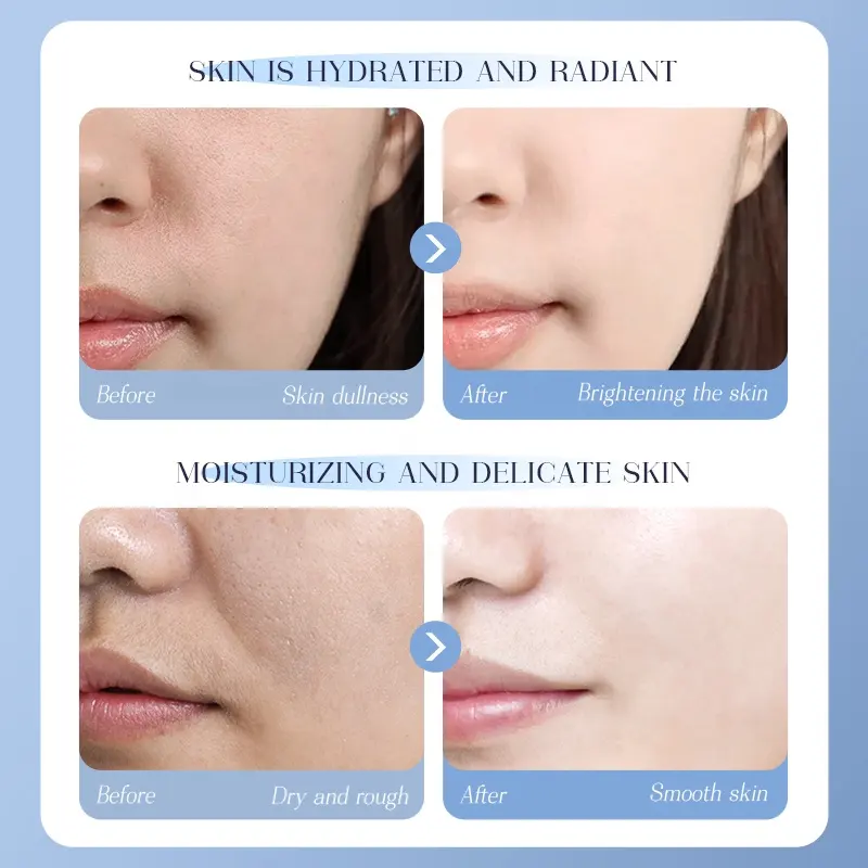 OEM Hyaluronic Acid Moisturizing Facial Mask Hydrating Relieving Dryness Sodium Hyaluronate Aloe Vera Colden Chamomile