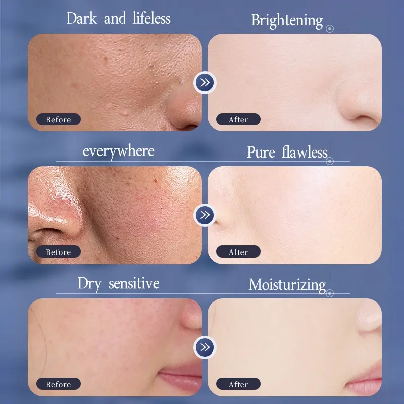 10pcs/Box Hydrating Cotton Facial Whitening Blemish Removal Brightening Dullness Improvement Yellowing Moisturizing Face Sheet