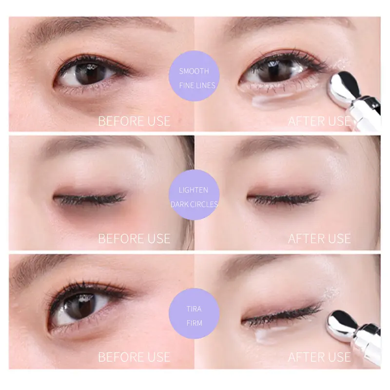 Customize Skin Care Korean Anti-wrinkle Under Eye Bag Removal Repair Lift Tightening Proxylane Dark Circle Massage Eye Cream