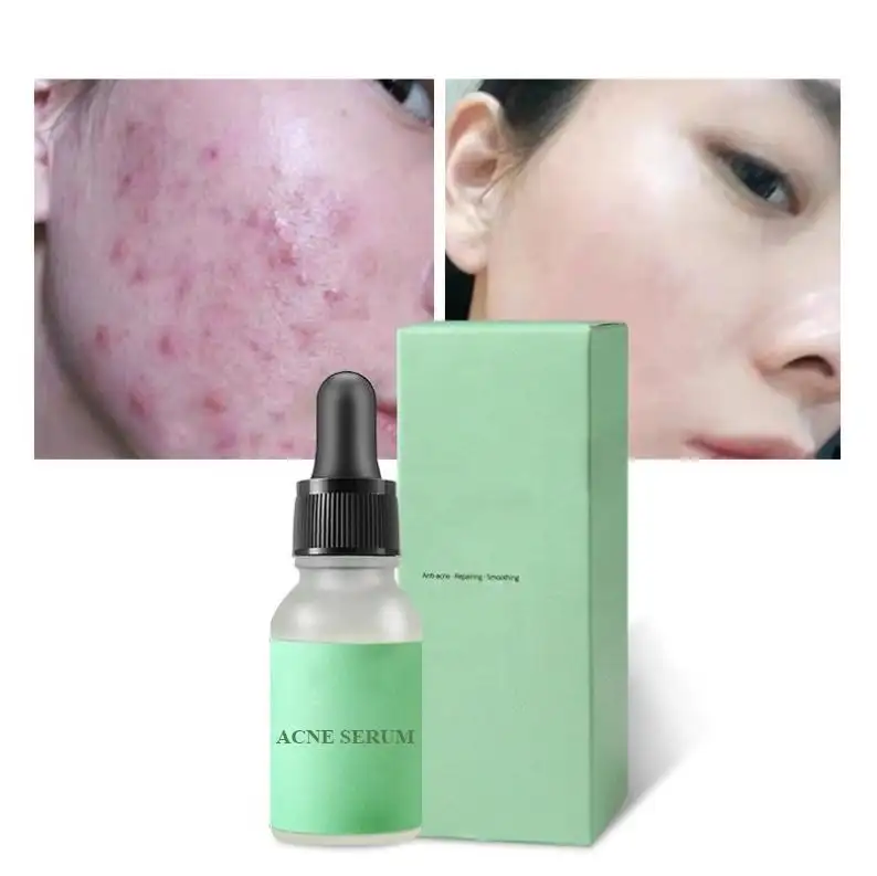Skin Serum Facial Serum Peptide Firming Hydronic Acid