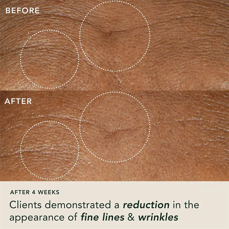 Squalane & Hyaluronic Face Serum 'Super Vital SERUM' Anti-aging Serum for Wrinkles - Lifting & Intense Hydration