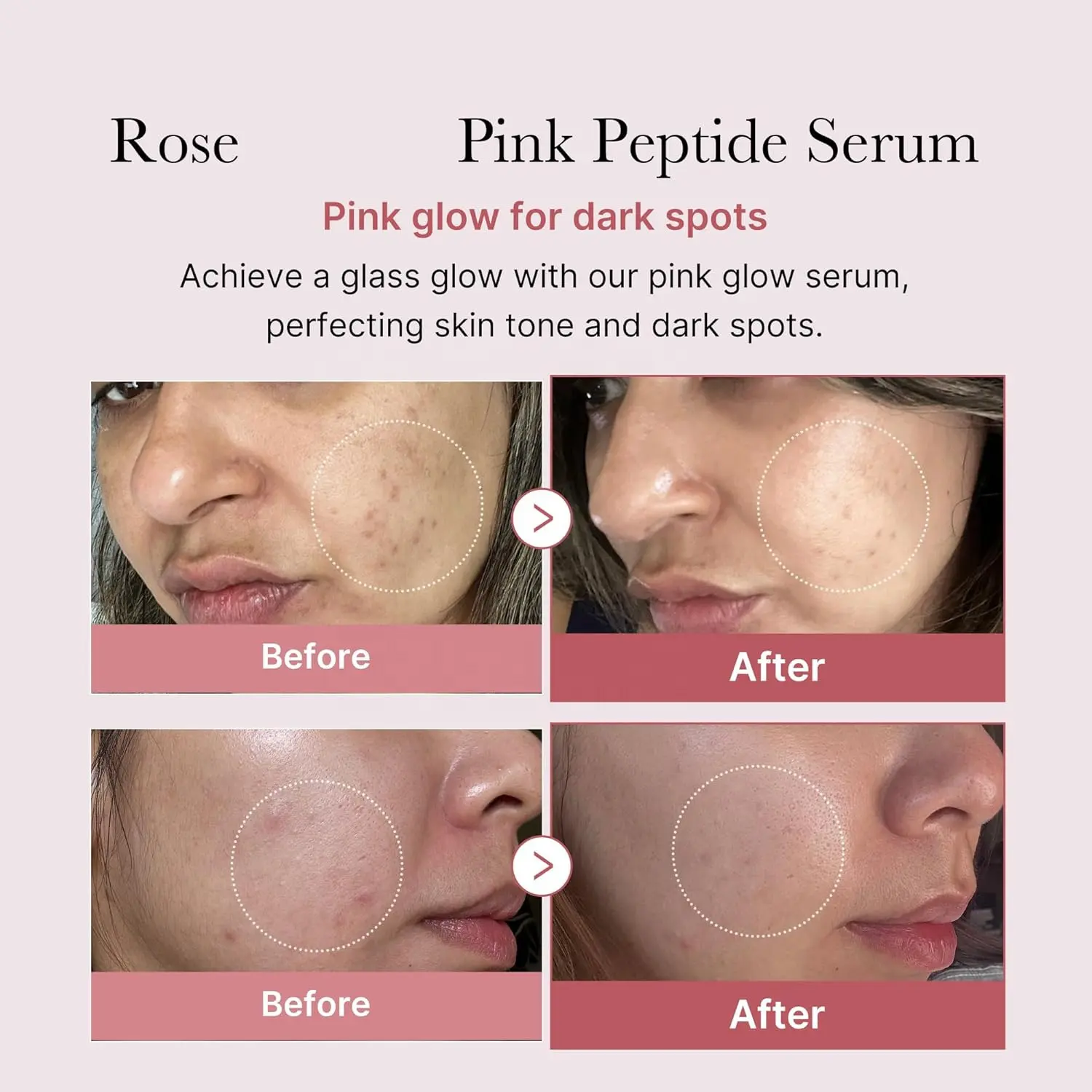 Lightening Pink Glow Facial Serum Wrinkle Aging Essence Vitamin Snail Turmeric Tea Niacinamide Tea Ingredients All Skin OEM