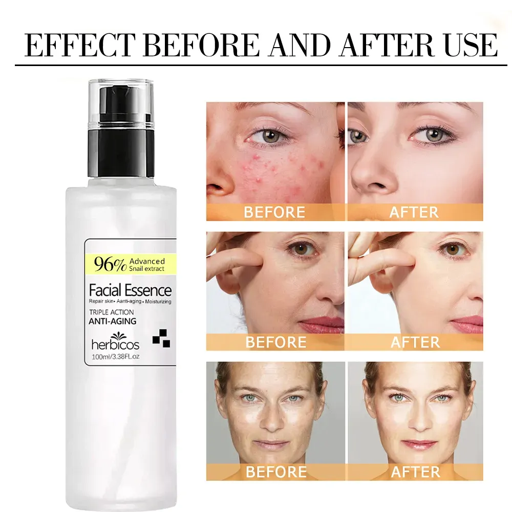 Korean Premium Snail 96 Mucin Power Essence Face Facial Serum Skincare Collagen Whitening Dark Spot Remover Skin Care Serum OEM