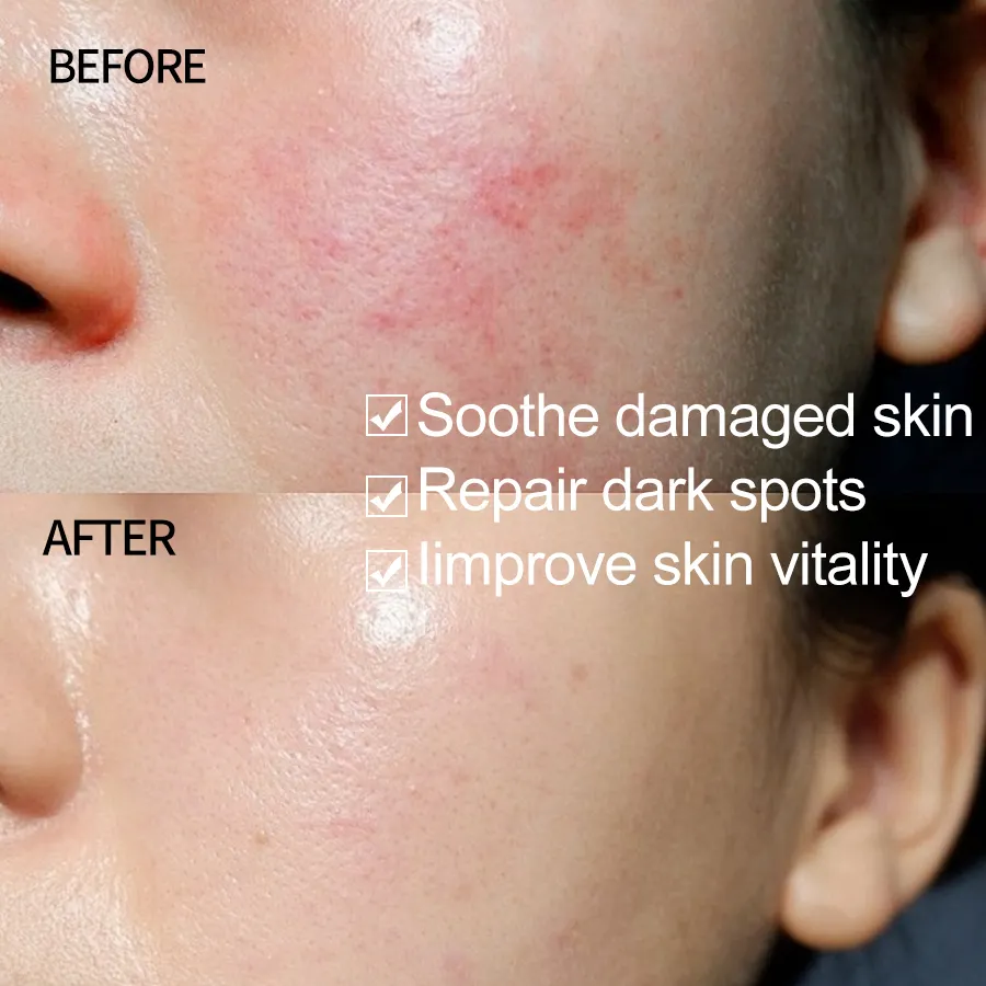 Private Label Skin Care Products Korean Cosmetics Moisturizing Whitening Serum 96 Mucin Power Essence Snail Serum
