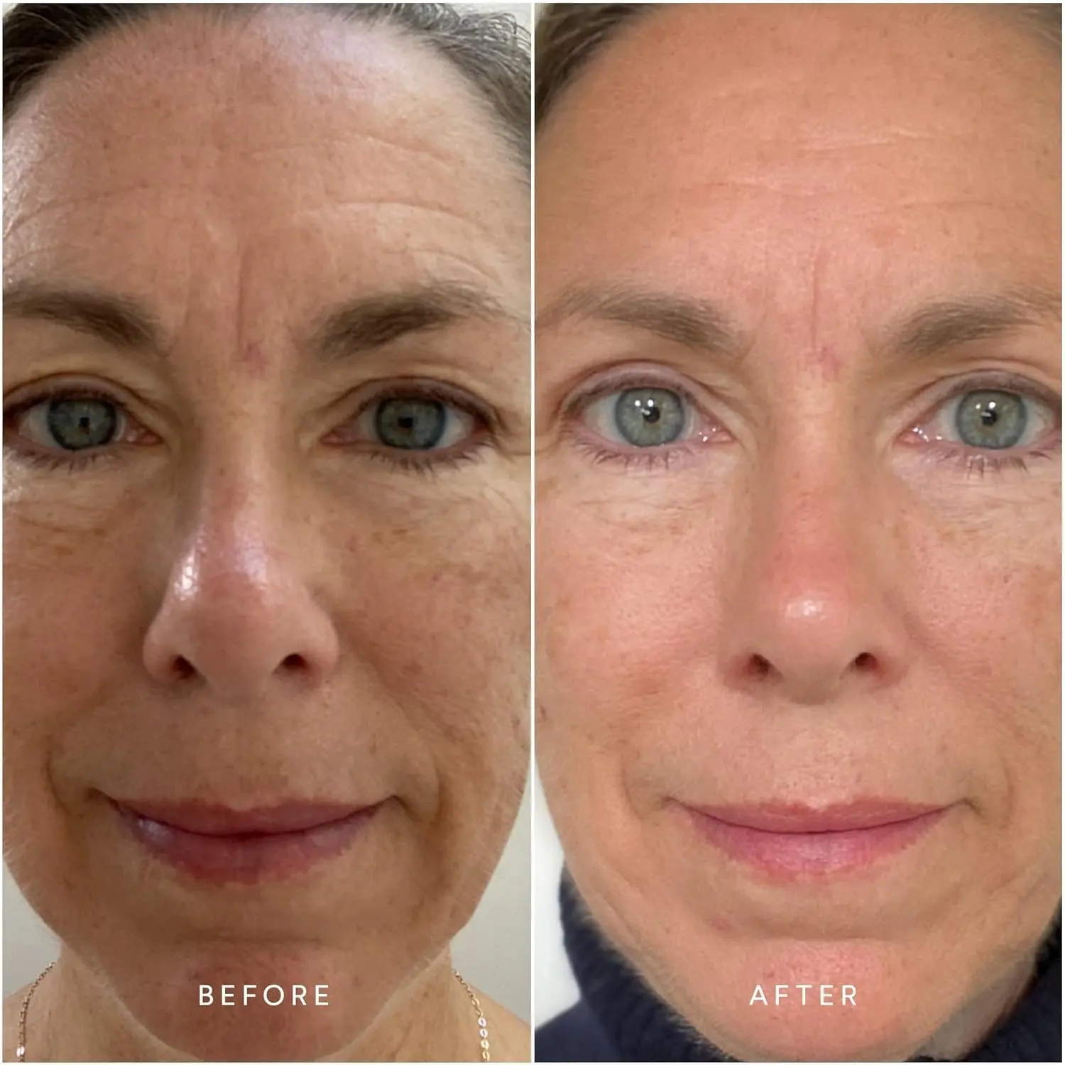 GHK-cu Face Serum Super Peptide Serum Anti-Aging Facial Oil with Copper Tripeptides for Plumping and Firming with Witch Hazel