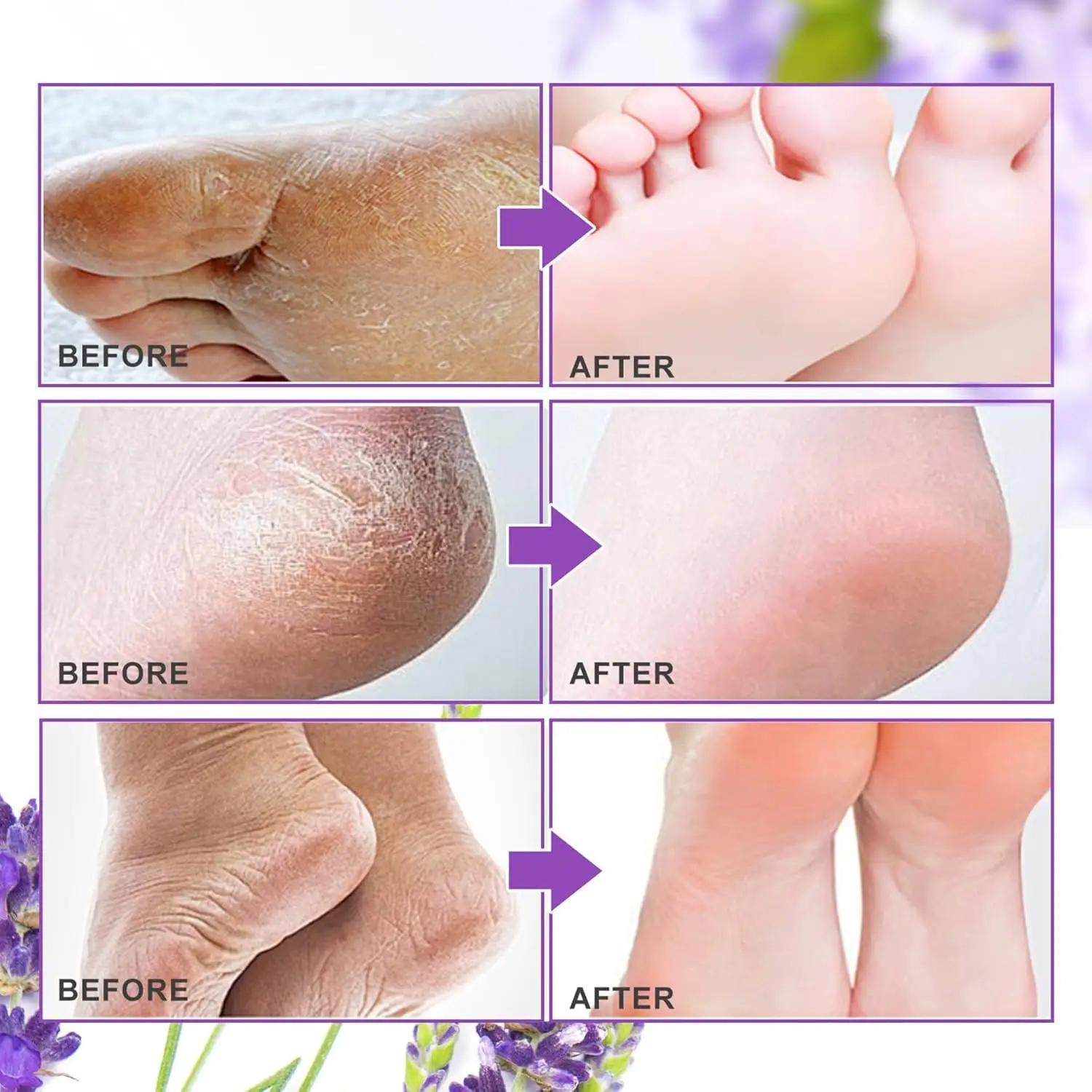 Foot Peel Mask 3 Pack, Exfoliator Peel Off Calluses Dead Skin Callus Remover, Baby Soft Smooth Touch Feet-Men Women detail