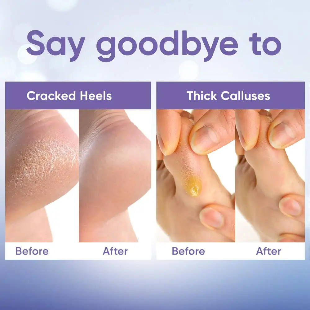 Herbal Foot Peeling Mask (3-pack) Exfoliating Peel off Calluses Dry Skin Cracked Heels for Smooth Moist Baby Skin for Adults