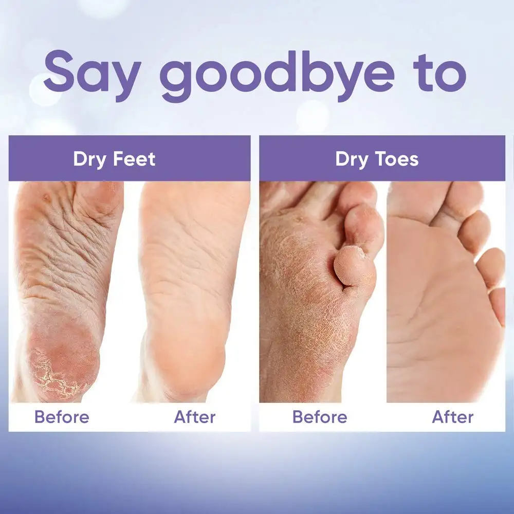 Herbal Foot Peeling Mask (3-pack) Exfoliating Peel off Calluses Dry Skin Cracked Heels for Smooth Moist Baby Skin for Adults