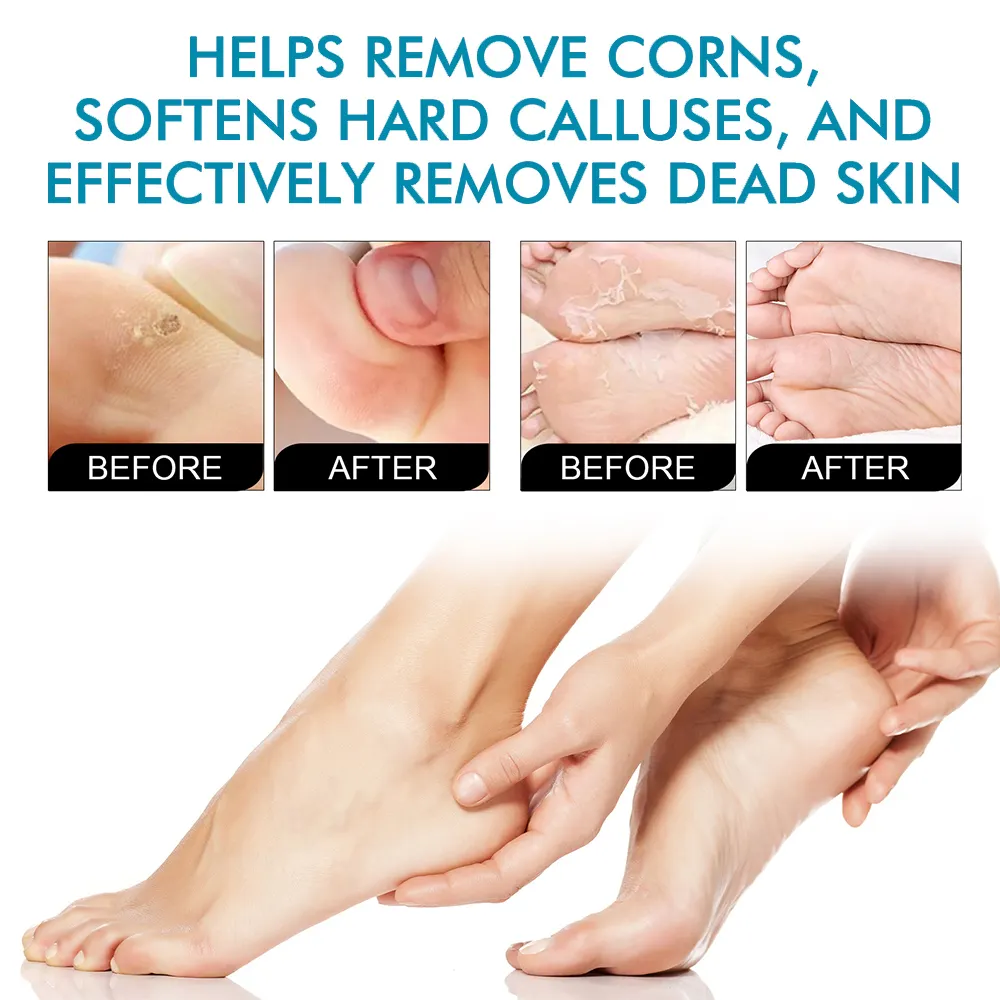 Herbicos Korean Foot Peeling Mask ODM/OEM Hydrating Cleansing Legs Private Adult Skin Care Wholesale Moisturizing Foot Mask detail