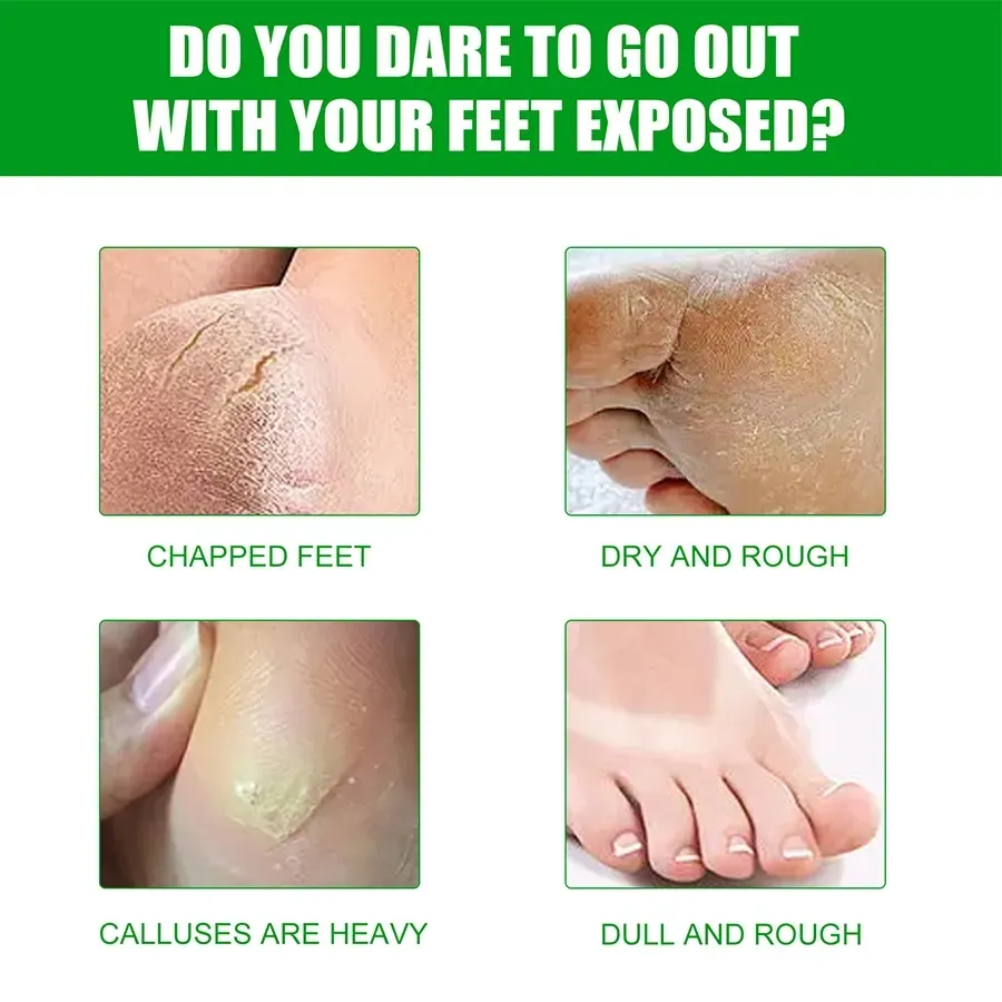 Private Label Olive Liquid Foot Mask Sheet Socks Exfoliating Peel for Deep Skin Care and Intensive Foot Care