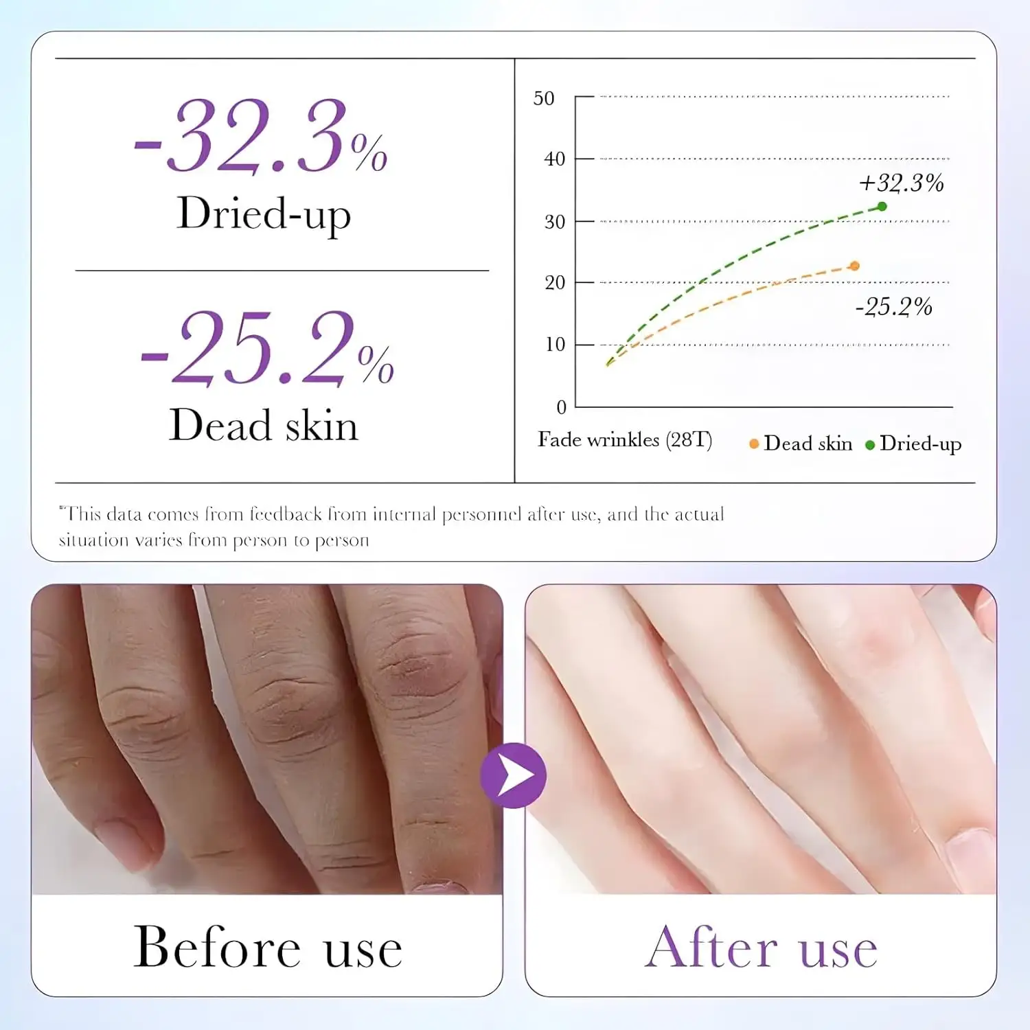 Hand Masks Moisturizing Glove, Hydrating Hand Masks for Dry Peeling Hands, Exfoliating Collagen Moisturizing Lavender Hand Mask