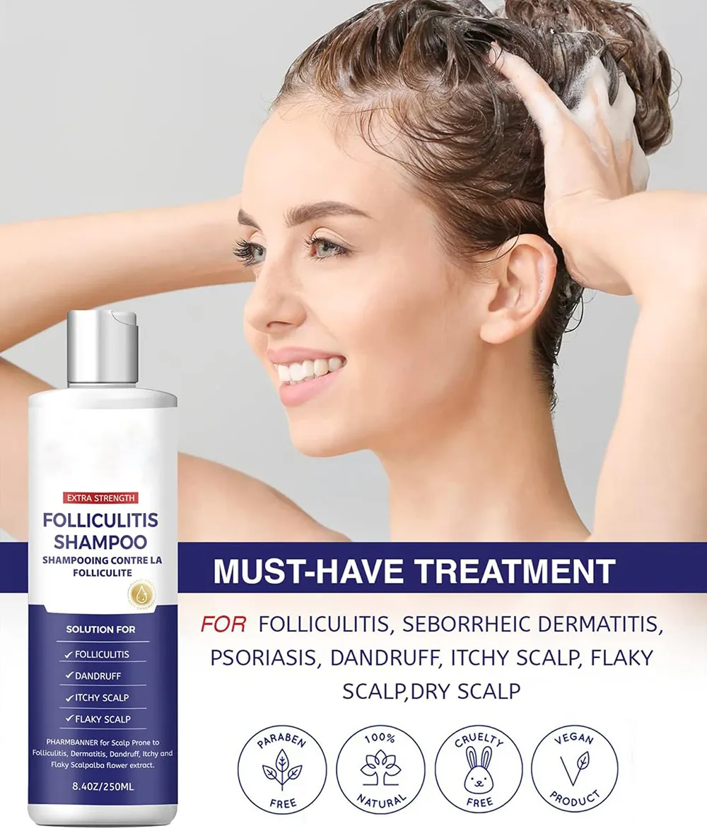 Moisturizing and Nourishing Anti-Dandruff Shampoo for Itchy Dry Scalp-Treats Folliculitis Seborrheic Dermatitis Psoriasis