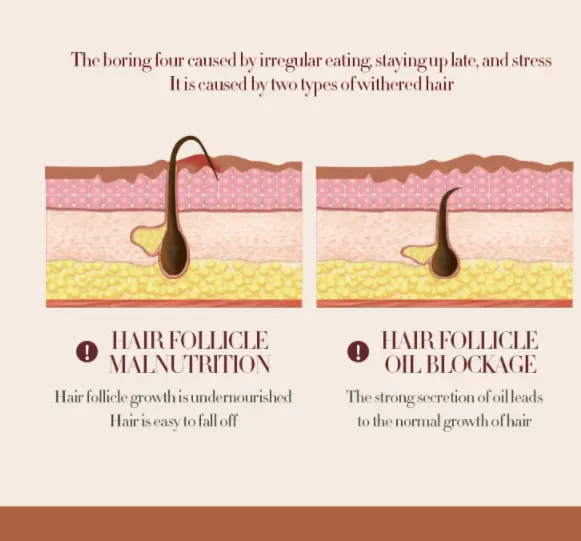 Customize Anti-Itching Anti-Dandruff Moisturizing Hair Shampoo 2-IN-1 Formula Color-Protection Private Label Custom Ingredients