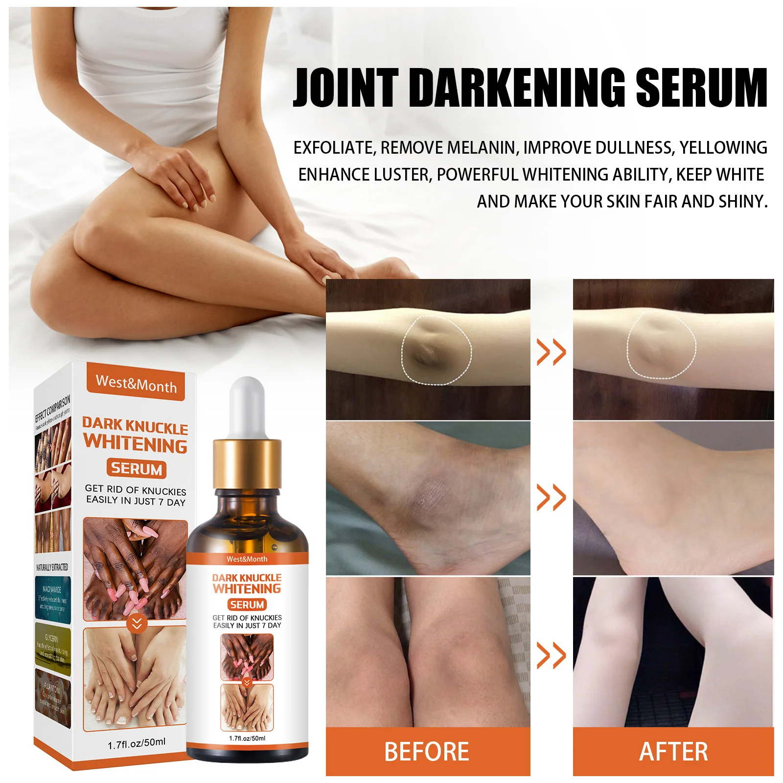 Serum production