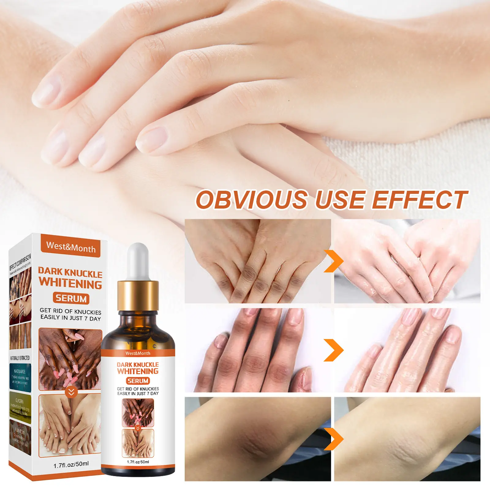 OEM ODM Skin Care Serum for Legs/Arms & Knees/Ankles Whitening Moisturizing Exfoliating with Niacinamide 50ml