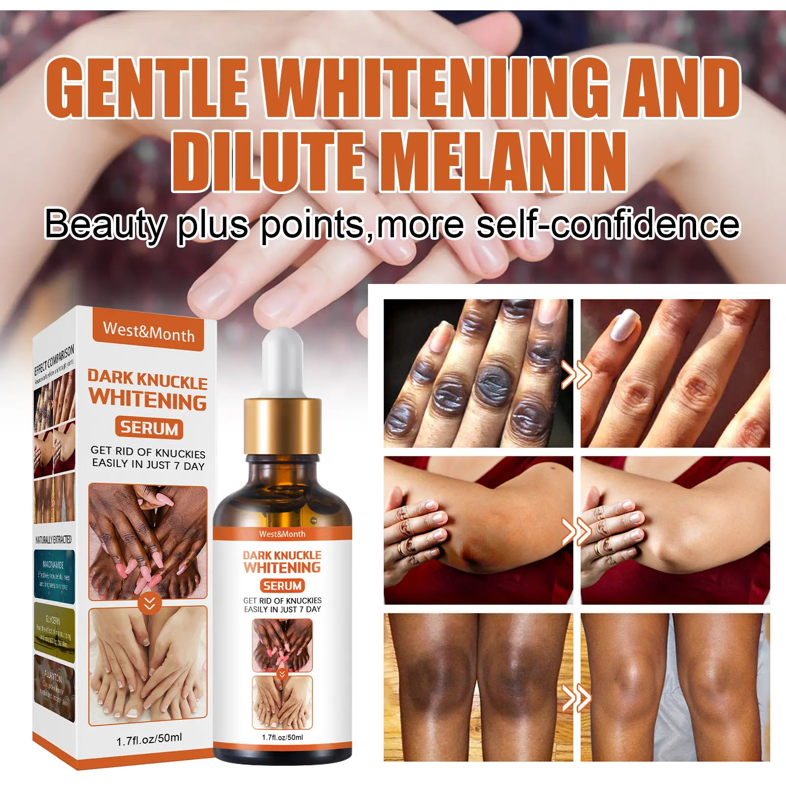 OEM ODM Skin Care Serum for Legs/Arms & Knees/Ankles Whitening Moisturizing Exfoliating with Niacinamide 50ml