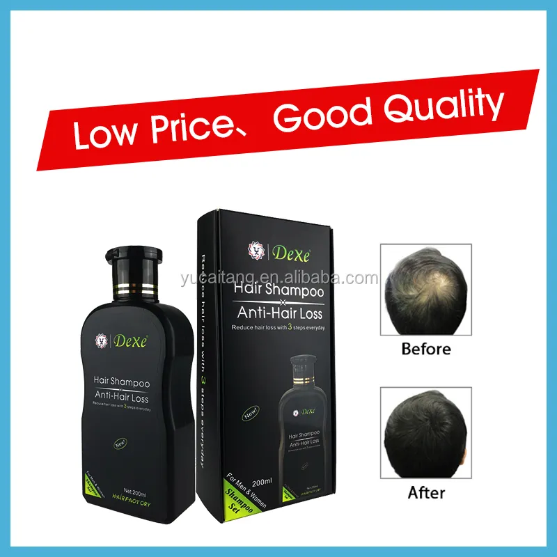 DEXE Herbal Anti-Hair Loss Cream Shampoo-High Quality Nourishing & Moisturizing for Home Use for Man and Women Use Private Label