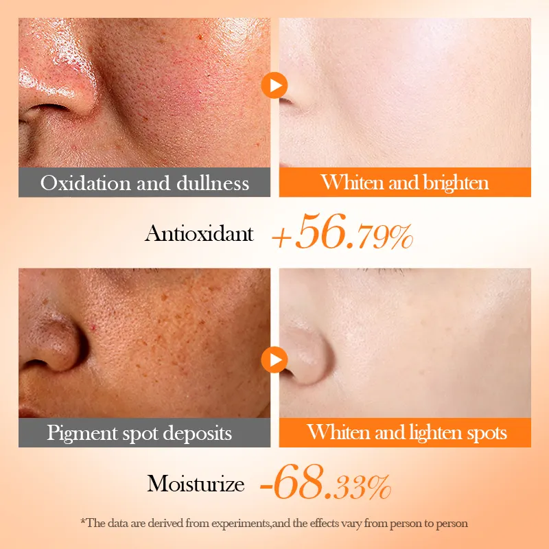 OEM BIOAQUA Private Label Natural Vitamin C Whitening Six-piece Set Antioxidant Moisturizing Face Skin Care Set for Women