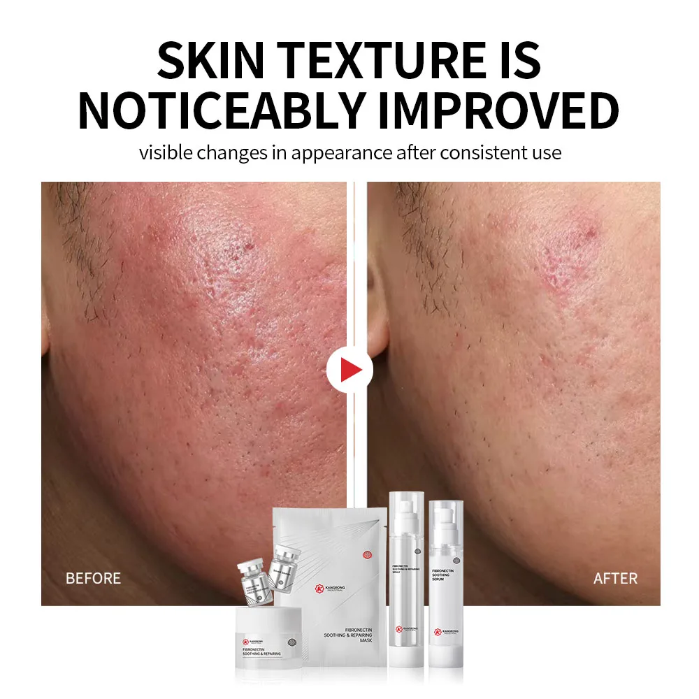 OEM Private Label Skincare Set Fibronectin Soothing Repairing Face Cream Spray Facial Serum Skin Care Repairs Damaged Skin
