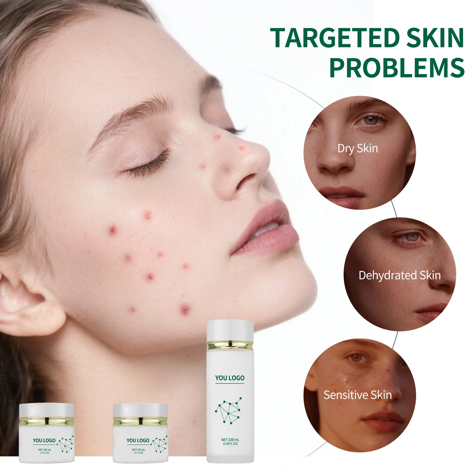 Private Label Acne Control Regimen Set Hyaluronic Acid Amino Acids + Ceramides Hydrating Moisturizer Salicylic Acid Zinc for Oil