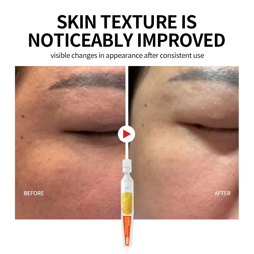 OEM Skin Rejuvenating Soothing Oil-Suspension Mono-dose Face Serum for Improves Skin Sensitivity Rebuild a Resilient Barrier