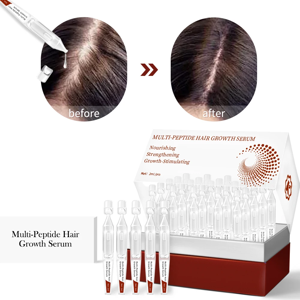 GMPC Factory Caffeine Biotinoyl Tripeptide 1 Hair Serum Strengthening Thickening Pea Extract for Thinning Hair MoCRA Ready