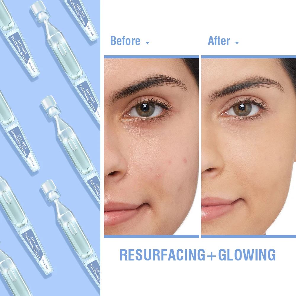 OEM ODM Skin Care Facial Exfoliating Pores Shrinking Oil Control Acne Mandelic Glycolic Salicylic Acid Ampoule Serum